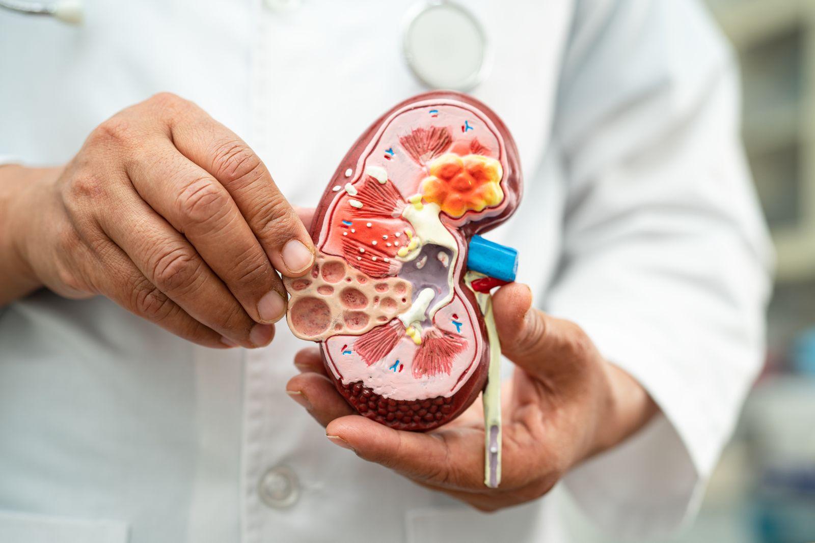 Kidney Issues & Transplant