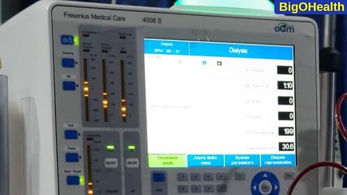 dialysis